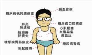警惕2型糖尿病并发症——预警与应对